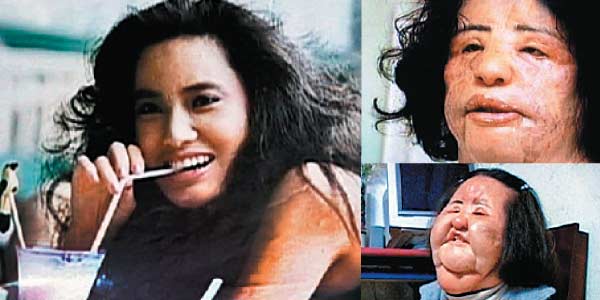 Father, mother did not know the identity of the needle into the monster's face was swollen and grotesque treatment of doctors and readying model awful